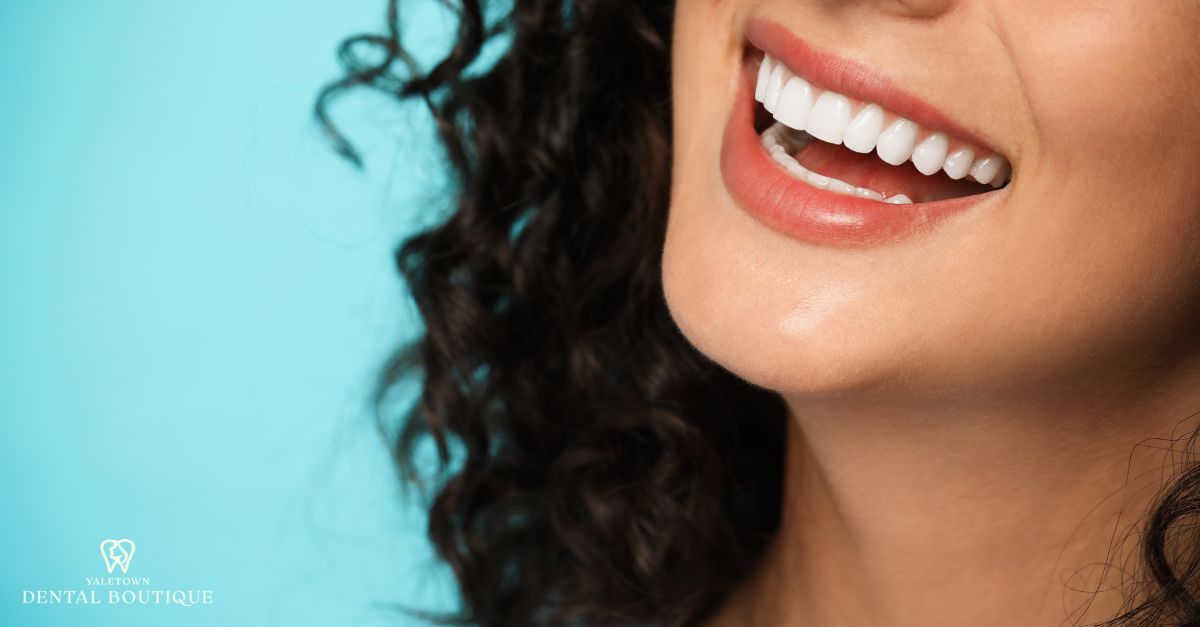 Close-up of a woman smiling with bright, even teeth after a digital smile makeover.