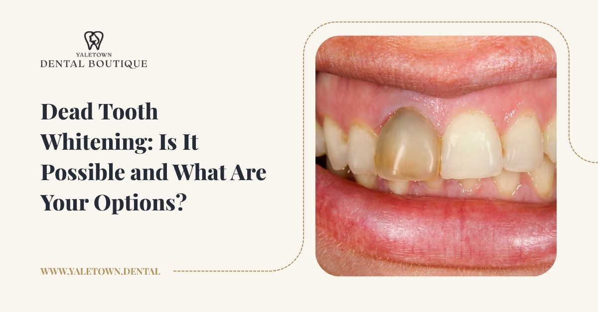 Dead Tooth Whitening: What Works and What Doesn’t