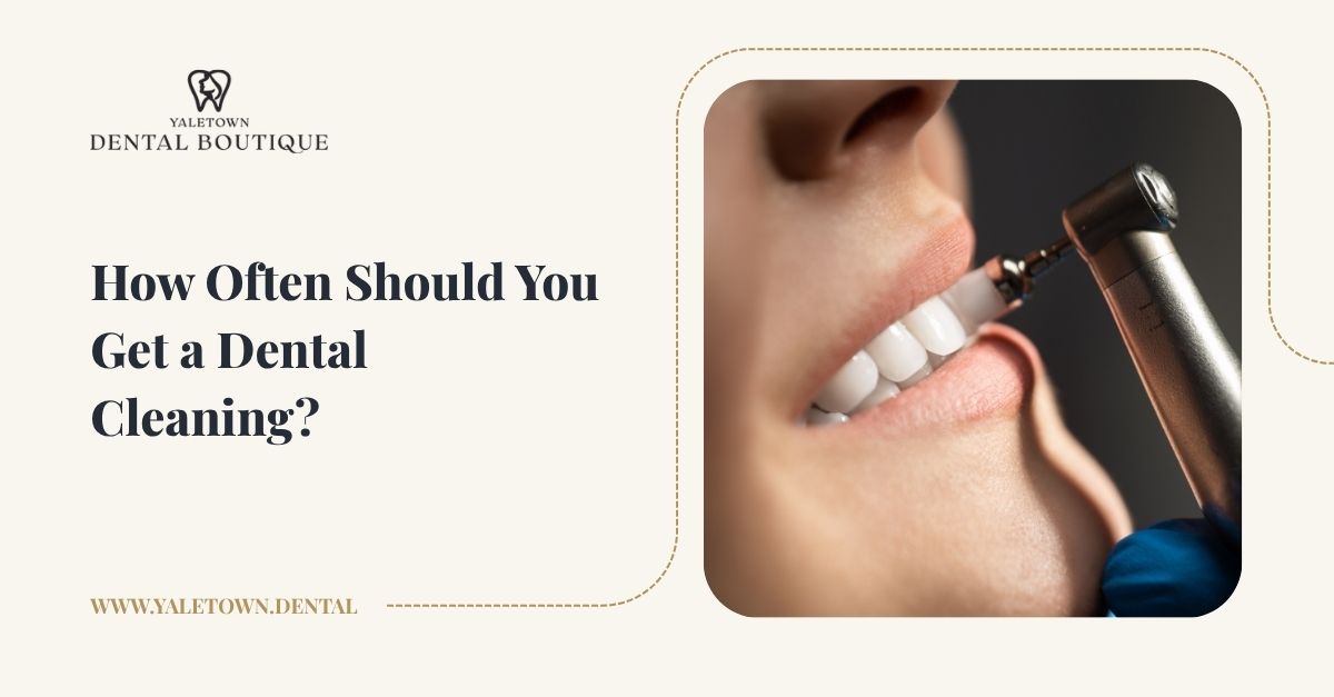 How Often Should You Get a Dental Cleaning?