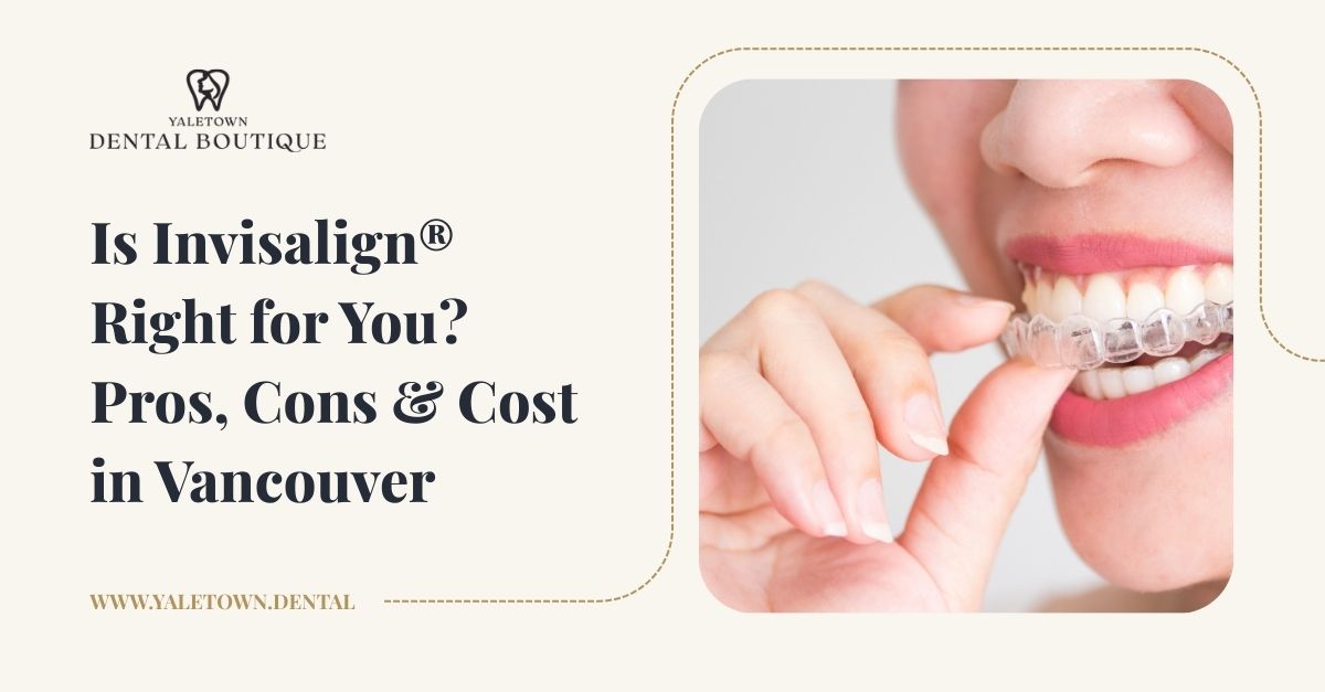Is Invisalign® Right for You? Pros, Cons & Cost in Vancouver