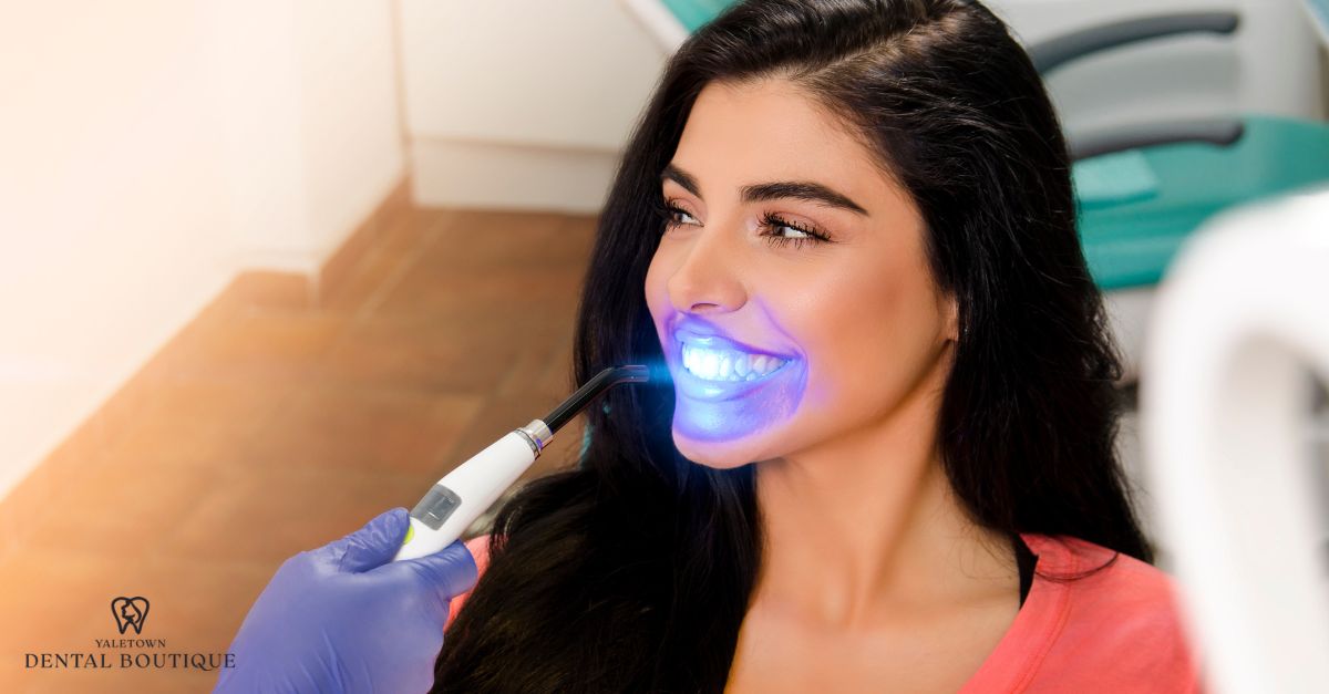 A person applies whitening gel to a front tooth using a brush-on whitening pen