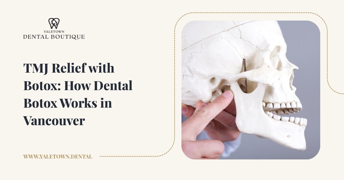 TMJ Botox in Vancouver: Non-Surgical Jaw Pain Relief