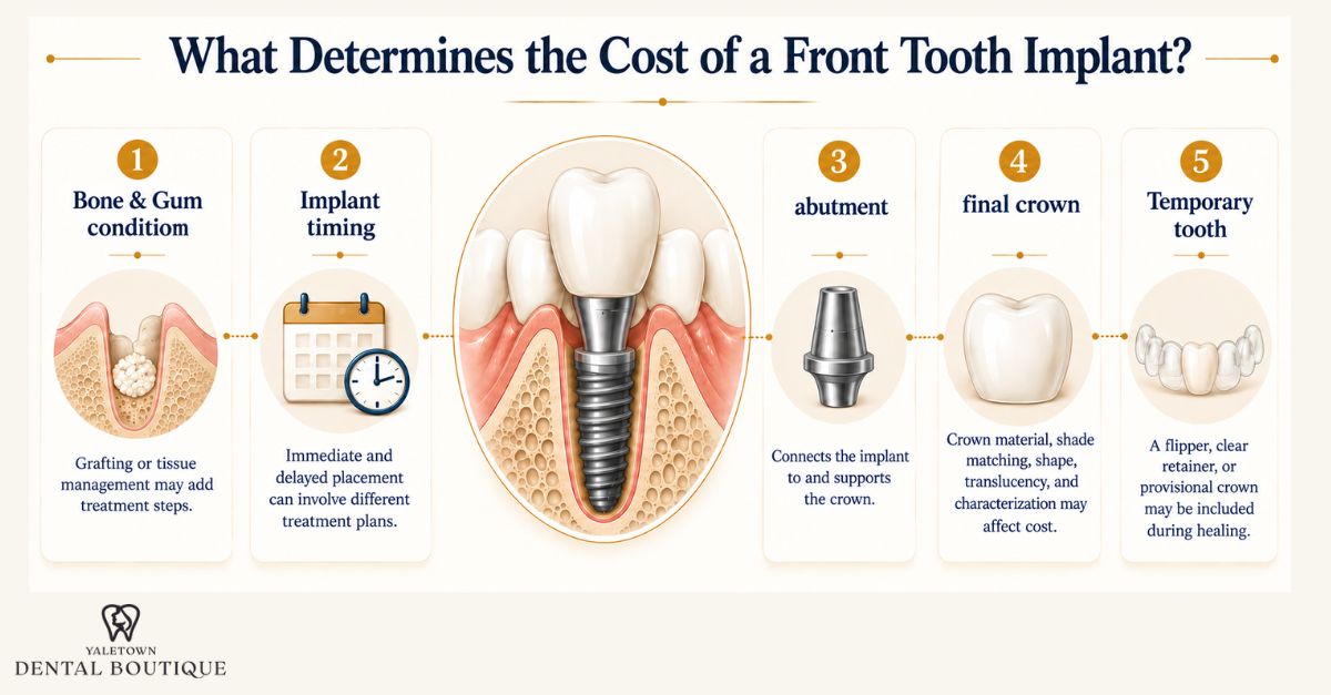 Infographic showing five factors that can affect front tooth implant cost: bone and gum condition, implant timing, abutment, final crown, and temporary tooth options.