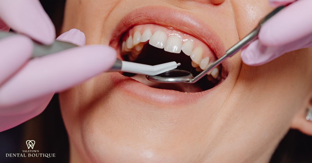 A dentist examining a sensitive tooth to identify the cause of ongoing discomfort.
