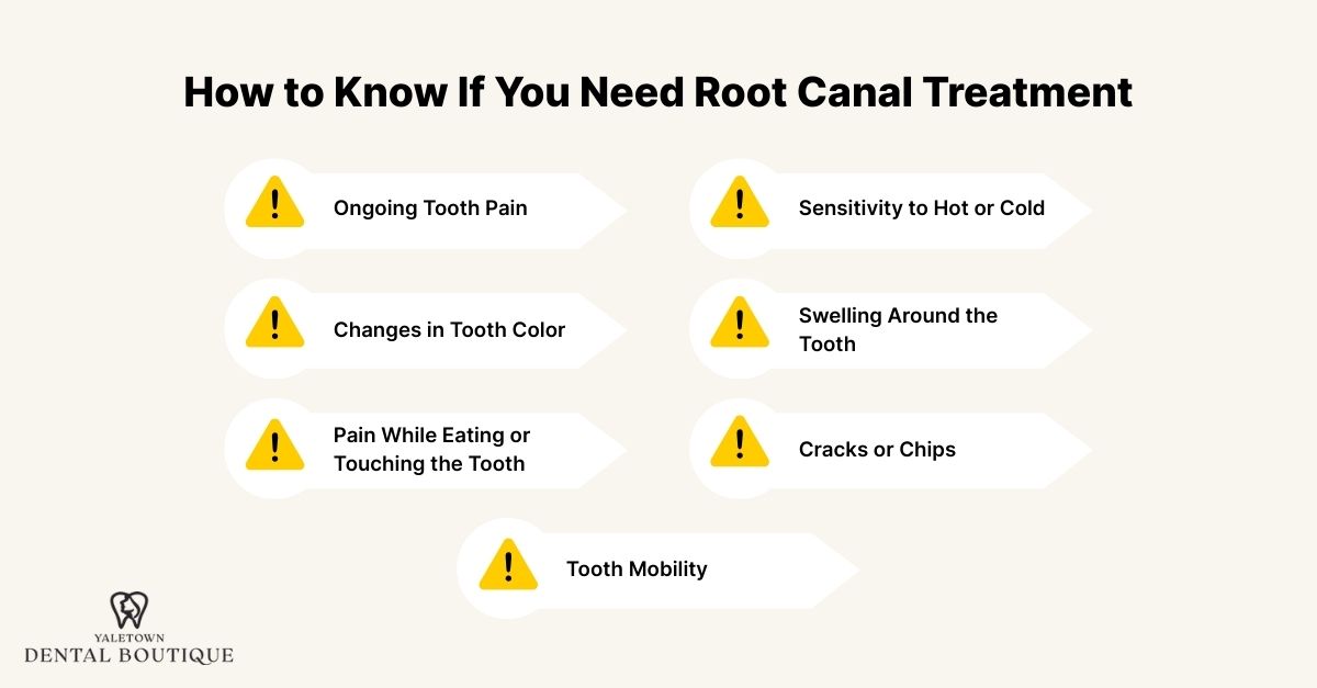 How to Know If You Need Root Canal Treatment