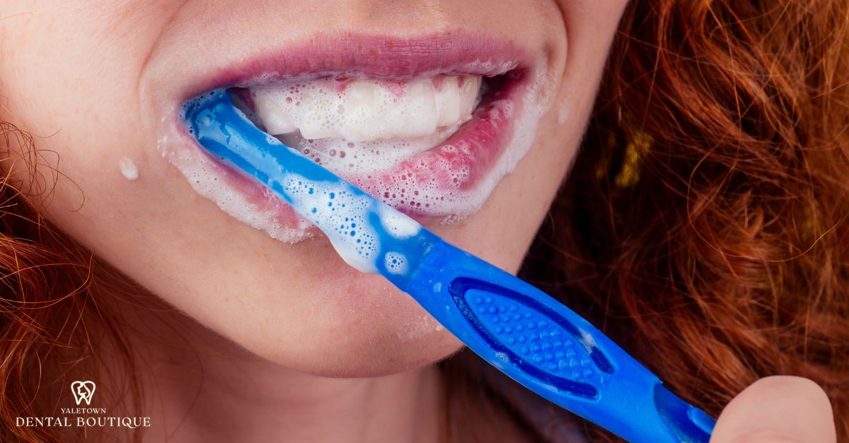 Close-up of a woman brushing her teeth, an essential step in caring for composite fillings.