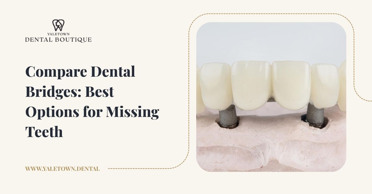 Replacing Missing Teeth? Compare the 4 Types of Dental Bridges