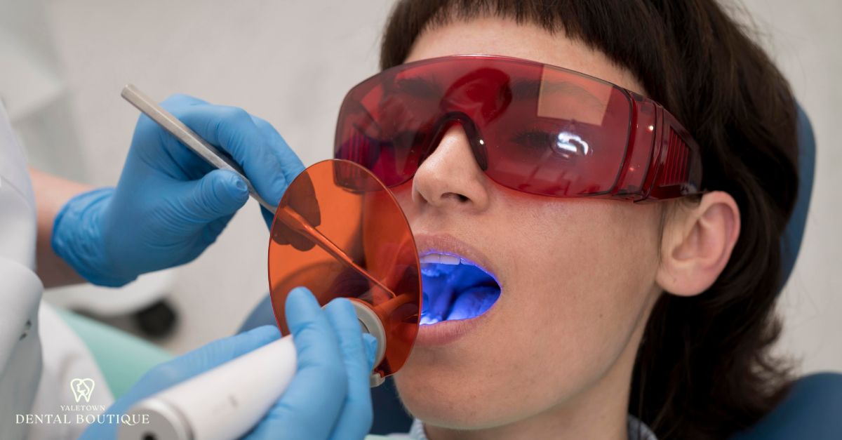 A dentist placing a composite filling with a curing light.