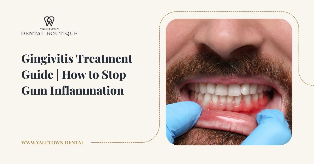 Gingivitis visible in swollen, irritated gums, highlighted during a dental check with gloved hands