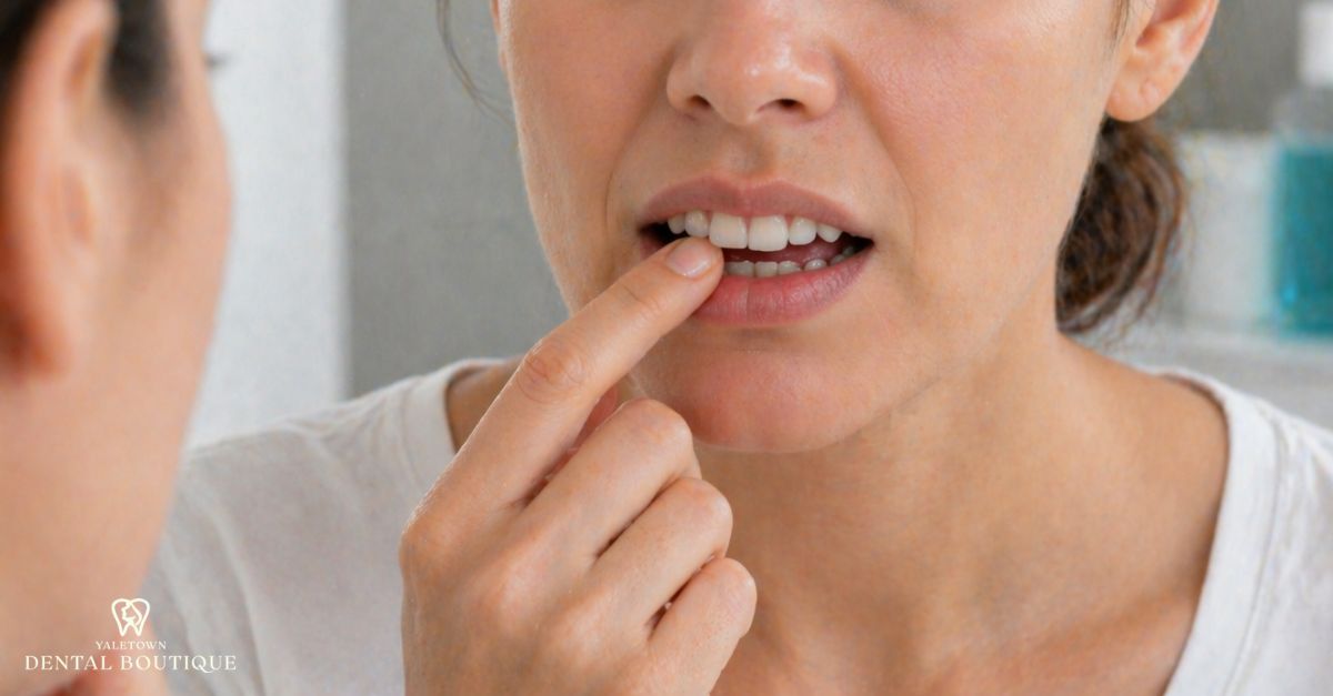 What to do right away if you have a loose tooth, shown by a person gently checking tooth movement in a mirror