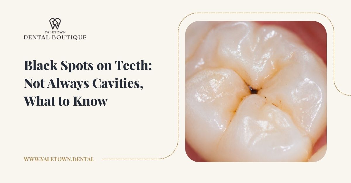 Tooth surface showing a dark spot that may be a stain or early change