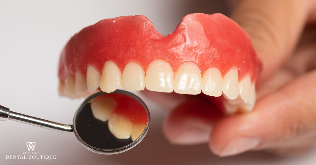 Removable full dentures as a traditional option for missing teeth